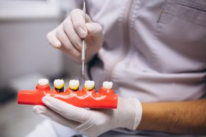 All on 4 vs All on 6: ¿Por qué dos implantes extra pueden cambiarlo todo?